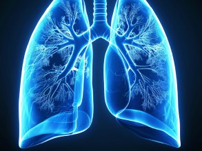 Webinar: Actualización en el manejo del quilotórax en el paciente pediátrico