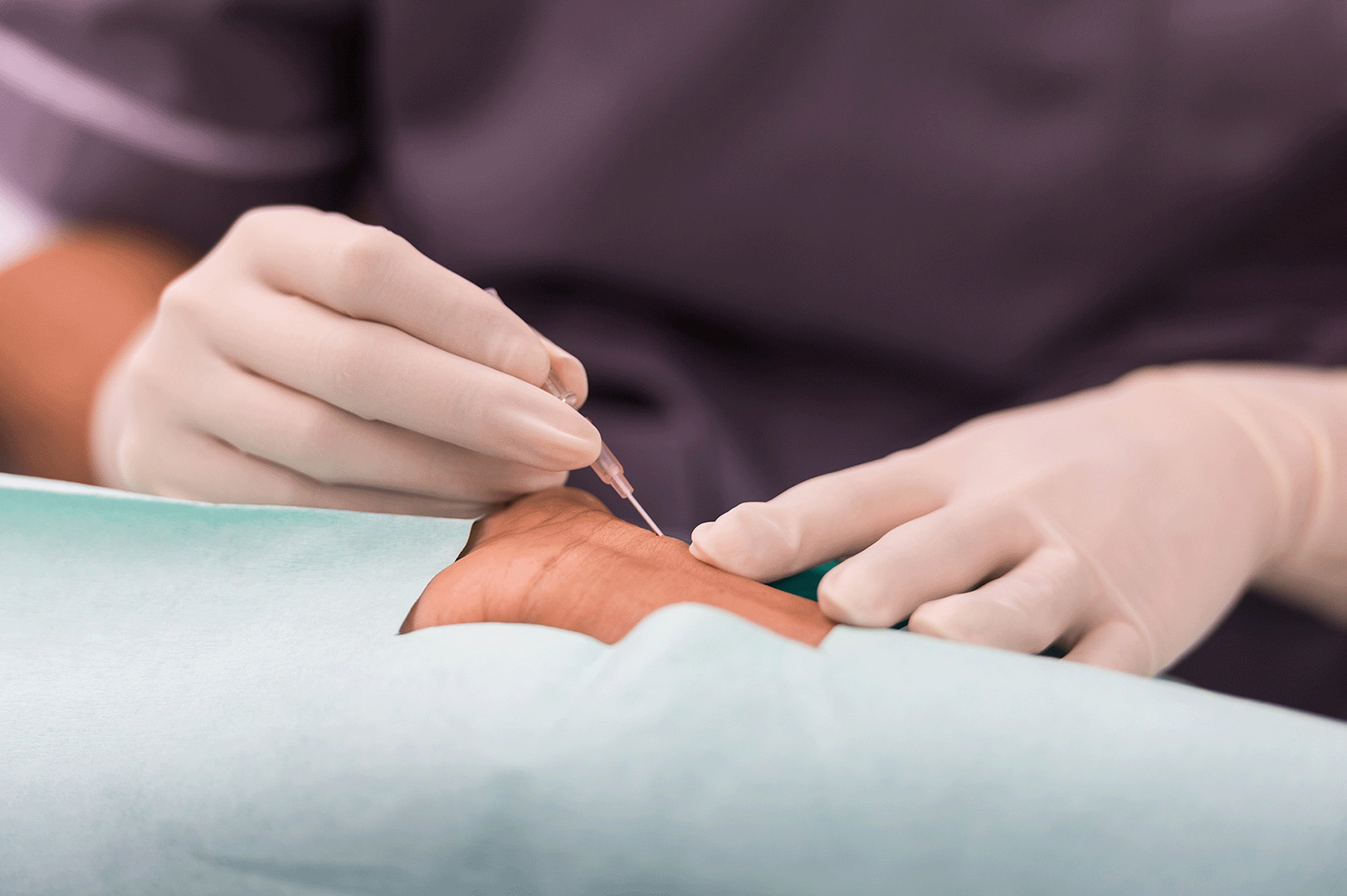 Which arterial line for the best arterial signal quality?